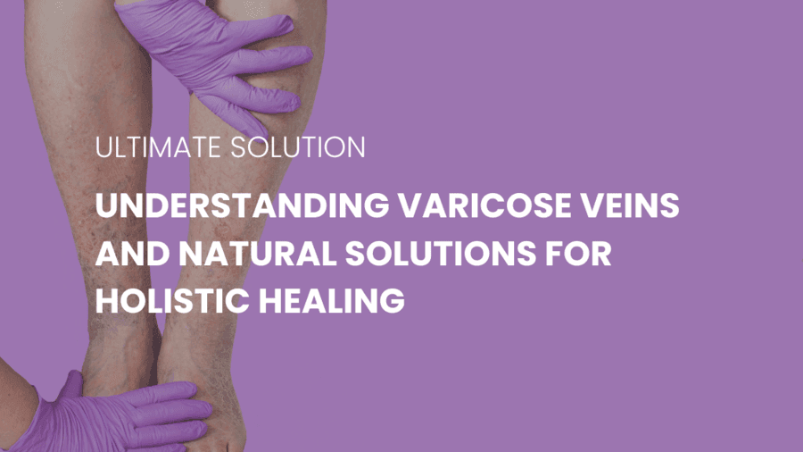 Understanding Varicose Veins and Natural Solutions for Holistic Healing